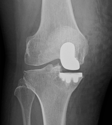 Xray UKR Xray UKR